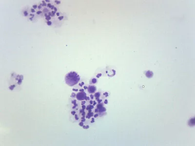 Buy Female Chromosome Smear, Human - Prepared Microscope Slide - 75x25mm - Eisco • 8.99$