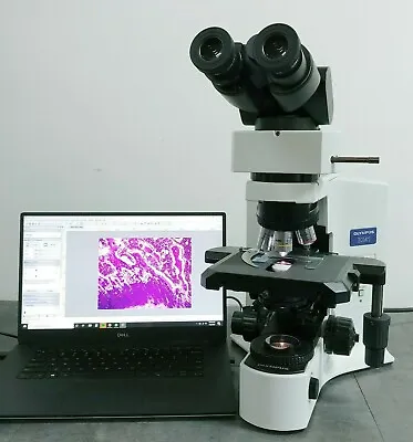 Buy Olympus Microscope BX41 With 2x Objective And 10 MP Camera • 6,374.50$