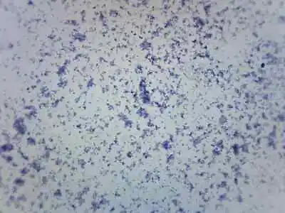 Buy Mycobacterium Tuberculosis - Gram Pos. - Prepared Slide - 75x25mm - Eisco Labs • 6.99$