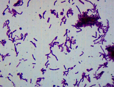 Buy 25pk Bacillus Smear, Gram(-), Prepared Microscope Slides - 75x25mm - Eisco Labs • 82.59$