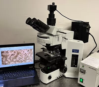 Buy Olympus BX51 Fluorescence Phase Contrast Microscope 5MP Cam + Laptop • 11,950$