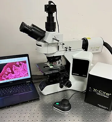 Buy Olympus BX43  Excelitas LED Fluorescence Microscope Trinocular 5MP CAM + Laptop • 12,950$