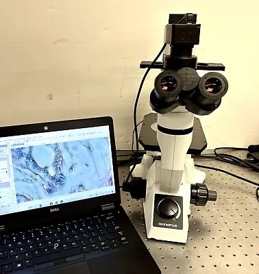Buy Olympus CKX41 Inverted Phase Contrast Microscope With Laptop + CAM • 5,750$