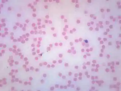 Buy 10PK Human Blood Smear - Prepared Microscope Slides, 75x25mm - Eisco Labs • 18.99$