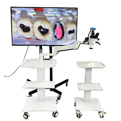 Buy Dental 10X Operating ENT Stereo Binocular Microscope With Camera And Mobile Cart • 2,498.99$