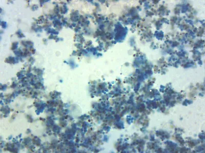Buy 25PK Saccharomyces Cerevisiae, Prepared Microscope Slides, 75x25mm - Eisco Labs • 27.99$
